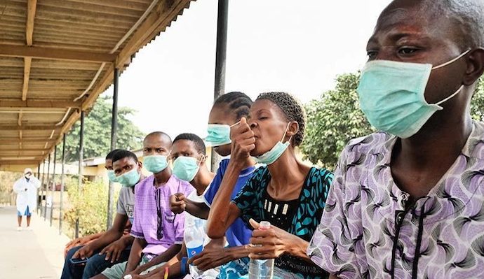 Nigeria Records 63% Drop in Tuberculosis Deaths Between 2015 and 2024